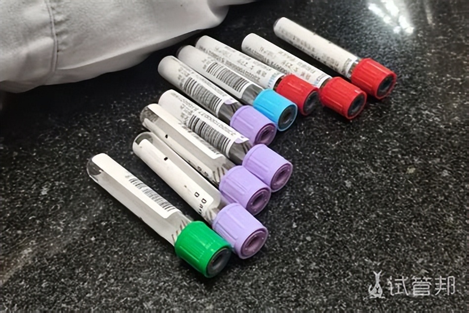 国外做试管婴儿的全部流程_试管就医流程详解_专业医生指导试管就医